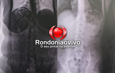 Penitenciária 603 flagra 13 mulheres com drogas no corpo