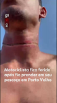 Motociclista ferido por cabo enrolado no pescoço em Porto Velho